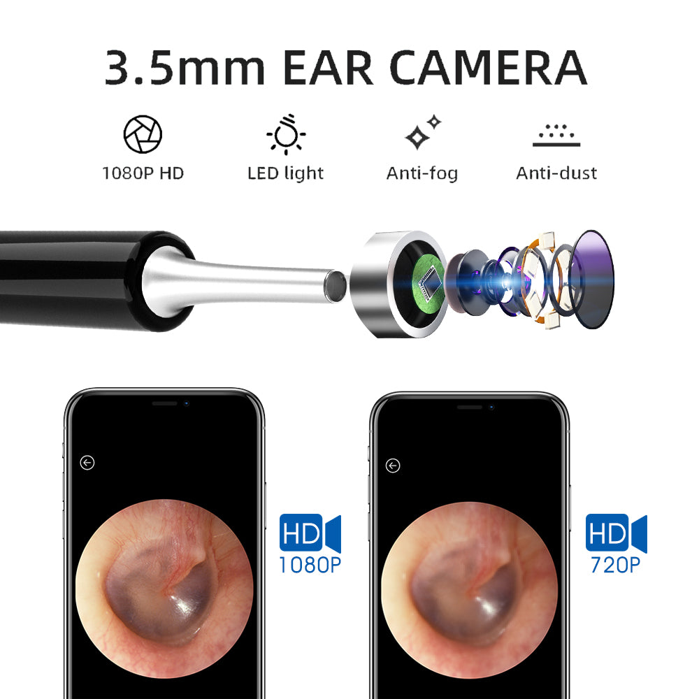 Ear Wax Removal, Earwax Cleaner Kit with Camera Earwax  Cleaning Remover Tool  with 1080P HD WIFI Endoscope and 6 LED Lights for iPhone, iPad and Android Smartphones